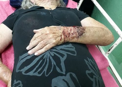 PM diz que idosa machucou ao cair e instaura inquérito policial para apurar denúncias em Santana dos  Montes