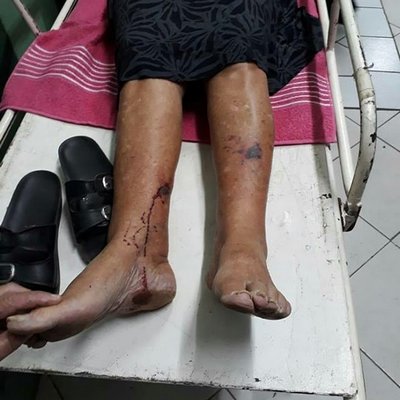 Agressão a idosa provoca revolta e manifestação em Santana dos Montes