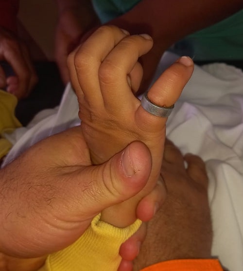 Criança de quatro anos fica com rolamento de aço preso no dedo