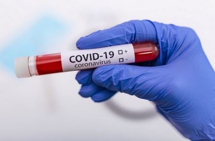 Dados atualizados sobre Covid-19 em Lafaiete