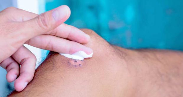 12 Pomadas Cicatrizantes Mais Conhecidas – Como Usar e Dicas