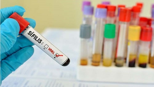 Sífilis cresce em Congonhas em 2022 e deve superar o total de registros do ano passado