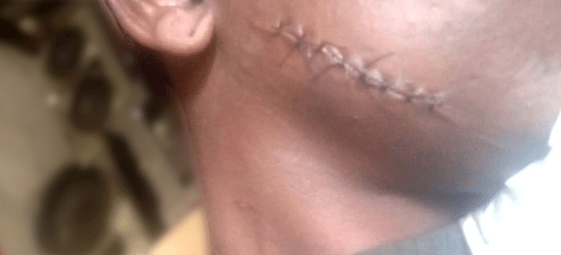 Mulher é agredida pelo ex-marido e sofre corte profundo no rosto