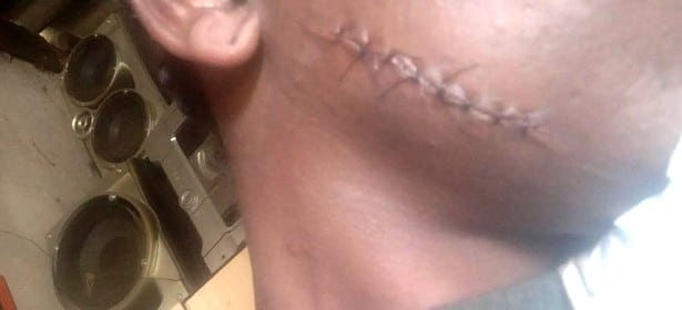 Mulher é agredida pelo ex-marido e sofre corte profundo no rosto