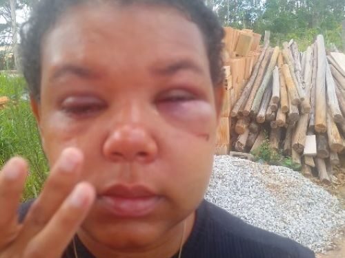 A dor de mais uma mulher agredida que pede justiça em Lafaiete