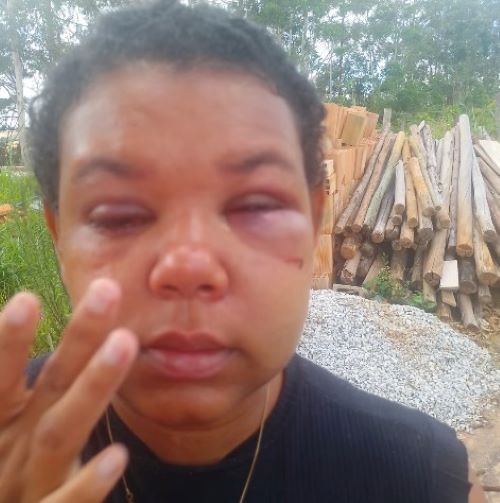 A dor de mais uma mulher agredida que pede justiça em Lafaiete