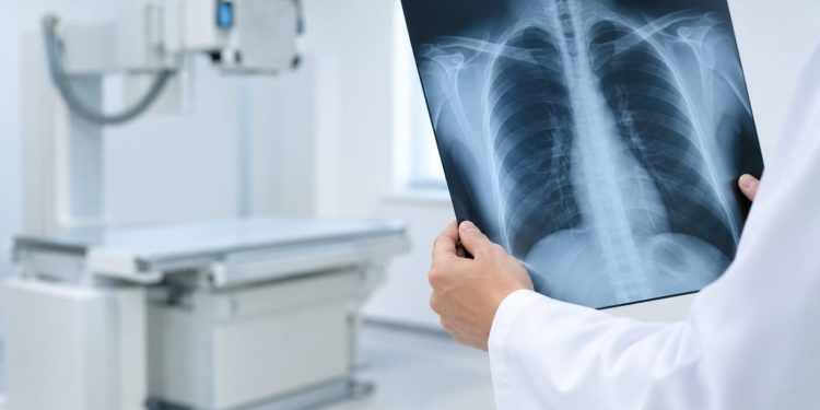 Após quatro meses, raio-X volta à rede pública de Lafaiete