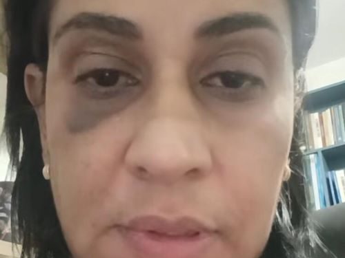 Professora de Lafaiete denuncia agressão após discussão política