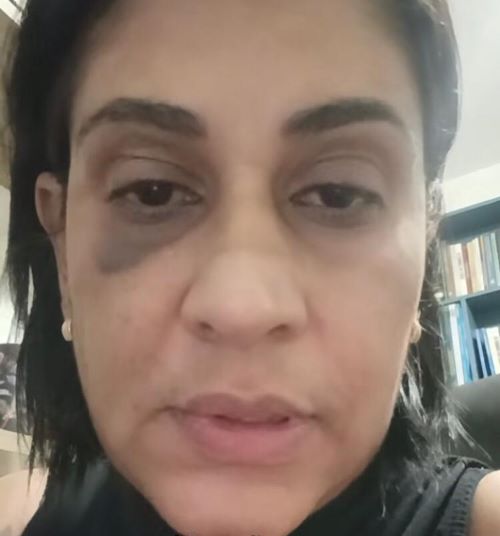 Professora de Lafaiete denuncia agressão após discussão política